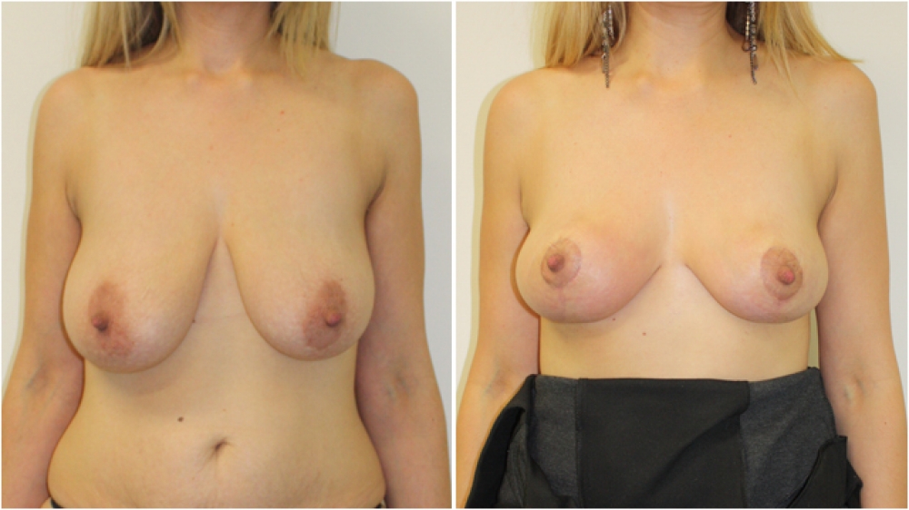 1257_patient-6-front